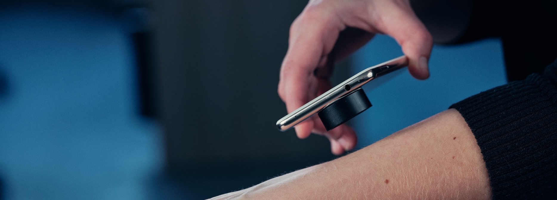 A smartphone with an attached device acts as a digital dermatoscope, helping to identify skin cancer
