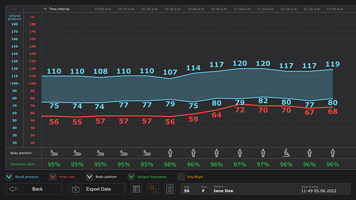 A graph in a mobile app that shows the blood pressure, heart rate, oxygen saturation, and body position of the patient.