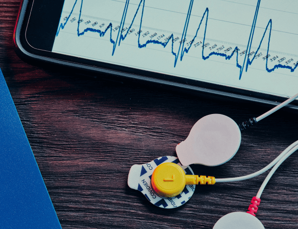 Real-Time Signal Processing for Wearable Electrocardiogram Device - Integra Source project