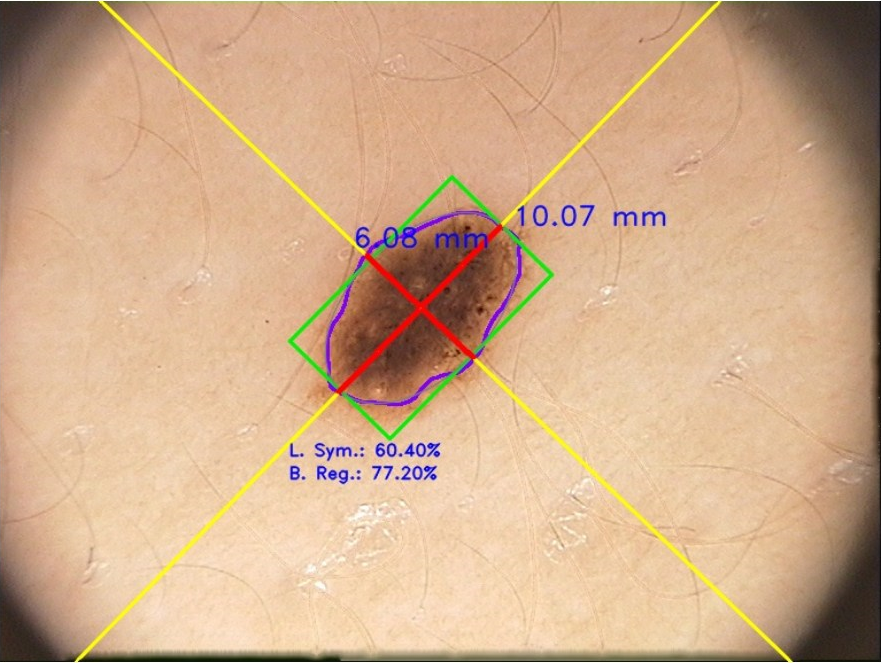 Mole parameters' measurement and analysis